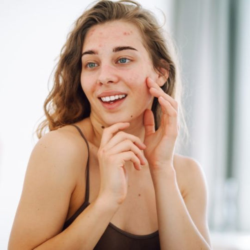 Spot Correction Cream Base ( Ready To Use )